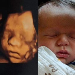 Baby's Debut 3d/4d Imaging - Baby's Debut 3d/4d Imaging