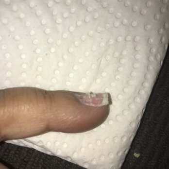 Star Nails II - The white in the middle of the nail, is my actual nail peeing in strips across, ugh wish I had better pics!! - Nail Salons Near Me - San Antonio, Texas Star Nails II - The white in the middle of the nail, is my actual nail peeing in strips across, ugh wish I had better pics!! - Nail Salons Near Me - San Antonio, Texas