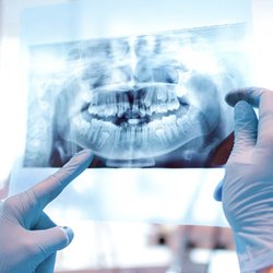 Our dentist and highly trained team not only treat patients, but also identify what caused the health concern in the first place.