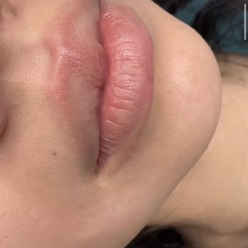 Beauty By Janice - This was a before picture from her page. Those are my lips ew crusty, no color. - Permanent Makeup Near Me - Temple City, California Beauty By Janice - This was a before picture from her page. Those are my lips ew crusty, no color. - Permanent Makeup Near Me - Temple City, California
