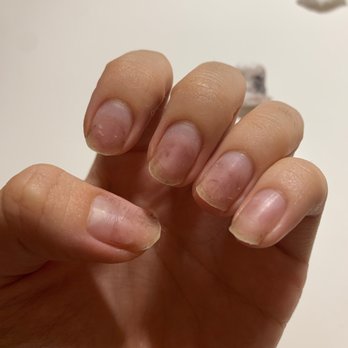 J and Z One Nails - My nails have become all scratched up and ruined, becoming so weak after getting a gel removal from this place. My nails get easily bent. - Nail Salons Near Me - New York, New York J and Z One Nails - My nails have become all scratched up and ruined, becoming so weak after getting a gel removal from this place. My nails get easily bent. - Nail Salons Near Me - New York, New York