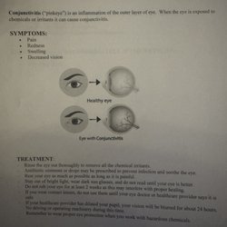 Lash N Brow Beauty Lounge - Chemical Conjunctivitis
