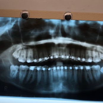 Joseph W Como DDS - my x-ray - Oral Surgeons Near Me - Hempstead, New York Joseph W Como DDS - my x-ray - Oral Surgeons Near Me - Hempstead, New York