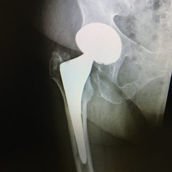 Messieh Orthopedic Clinic - Orthopedists Near Me - Winter Haven, Florida Messieh Orthopedic Clinic - Orthopedists Near Me - Winter Haven, Florida
