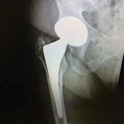 Messieh Orthopedic Clinic