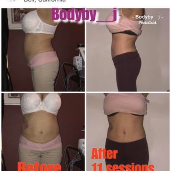 Body by J - Body contouring - Body Contouring Near Me - Downey, California
