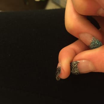 Broomfield Nail Care - The other cut I got, it's been a couple weeks and I still have a scar from it - Nail Salons Near Me - Broomfield, Colorado