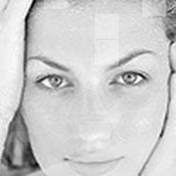 Azizta Laser Spa