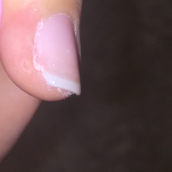 Studio Nails And Spa - This is how one of my nails looked after they were done filling! (It's the same finger with the cut) - Nail Salons Near Me - Hutto, Texas Studio Nails And Spa - This is how one of my nails looked after they were done filling! (It's the same finger with the cut) - Nail Salons Near Me - Hutto, Texas