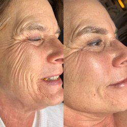 Natural Rejuvenation MedSpa