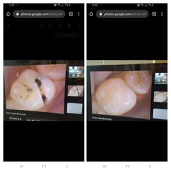 Best Dentures Near Me June 2021 Find Nearby Dentures Reviews Yelp