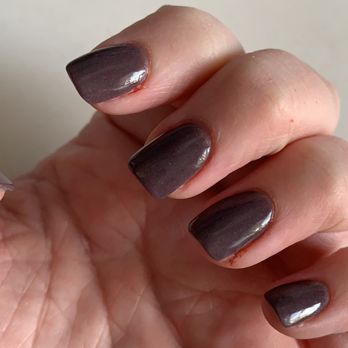 Nails Studio II - Bloody cuticles due to bad manicure. - Nail Salons Near Me - Washington, Pennsylvania Nails Studio II - Bloody cuticles due to bad manicure. - Nail Salons Near Me - Washington, Pennsylvania