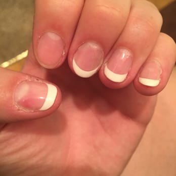Allure Nails and Spa - Gel: thumb has uneven glob. Index finger polish is off. Middle finger is lifting off. This is LESS than 48 hours after service. - Nail Salons Near Me - Fullerton, California Allure Nails and Spa - Gel: thumb has uneven glob. Index finger polish is off. Middle finger is lifting off. This is LESS than 48 hours after service. - Nail Salons Near Me - Fullerton, California