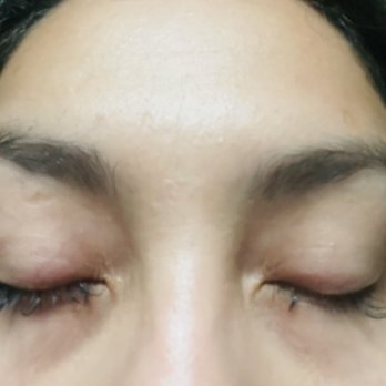 La Noir Lashes - My eyelids red and puffy from lashes being glued onto them - Eyelash Service Near Me - Cypress, California La Noir Lashes - My eyelids red and puffy from lashes being glued onto them - Eyelash Service Near Me - Cypress, California