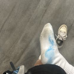 The shoes dyed my socks