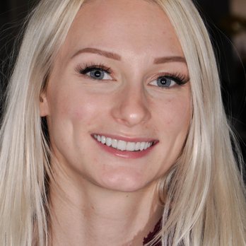 Stuart Boyse, DDS: Boyse Dentistry - after invisalign, veneers, and composite resin bonding - General Dentistry Near Me - Mesa, Arizona