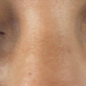 LeahLASH Studio - Inner conner gone, you can see one falling - Eyelash Service Near Me - The Colony, Texas