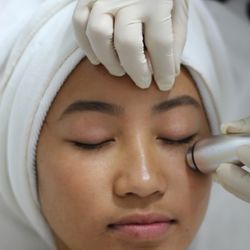 RF Probe for eye area: relieves eye fatigue