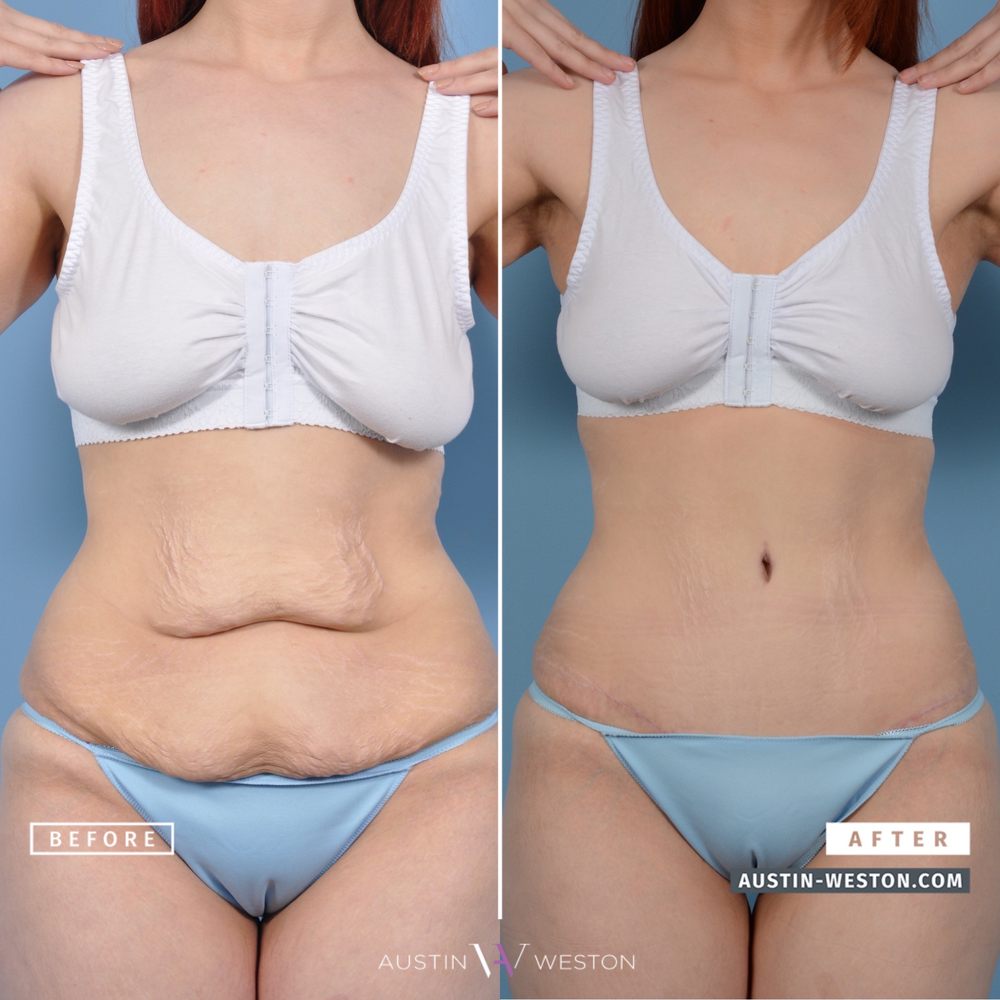 AUSTINWESTON CENTER FOR COSMETIC SURGERY 51 Photos & 100 Reviews