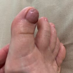 Plainfield Nails & Spa - She "fixed" stepping on my nail by adding more layers with the undercoat not dry.