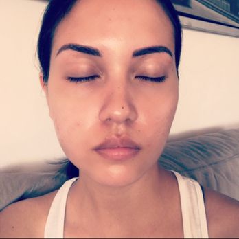 Icon Microblading - Post Microblading, day 1. Beautiful job by Nikita! - Permanent Makeup Near Me - New York, New York