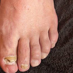 Foot-O-Logy