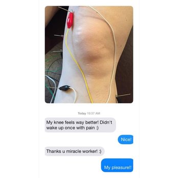 The Rehab Lab - Another happy client! - Acupuncture Near Me - Toronto, Ontario The Rehab Lab - Another happy client! - Acupuncture Near Me - Toronto, Ontario