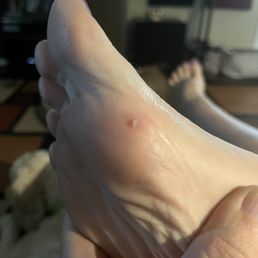 She cut my foot with the cheese grater. She cut my foot with the cheese grater.