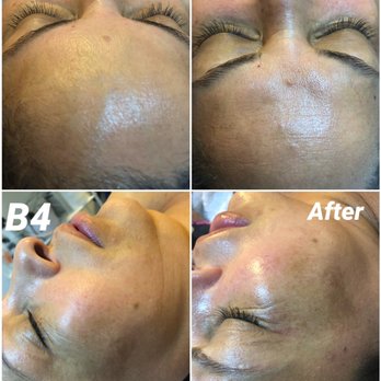 Stephanie Labarr - O2 lift with microdermabrasion - Day Spas Near Me - Manteca, California Stephanie Labarr - O2 lift with microdermabrasion - Day Spas Near Me - Manteca, California