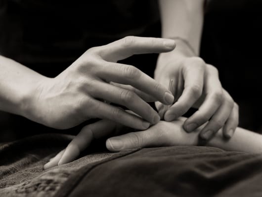 Daniel Min Acupuncture