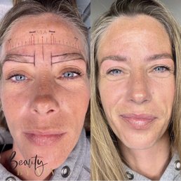 Before & After