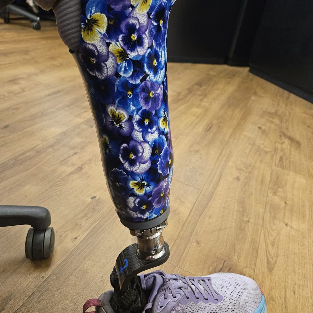 Roadrunner Prosthetics - Prosthetics Near Me - Phoenix, Arizona Roadrunner Prosthetics - Prosthetics Near Me - Phoenix, Arizona