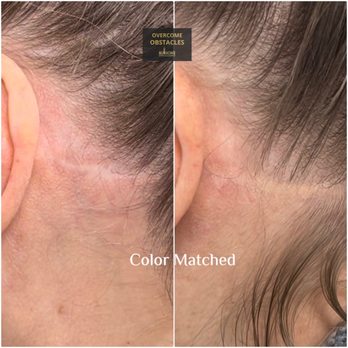 Illusions by Ink Studio - Cover your scars in Dallas, Texas - Tattoo Near Me - Coppell, Texas Illusions by Ink Studio - Cover your scars in Dallas, Texas - Tattoo Near Me - Coppell, Texas