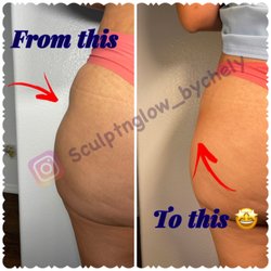 Sculpt & Glow by Chely - Dip hip correction