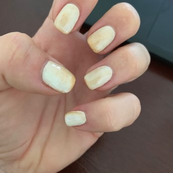 Oasis Nails - Burnt nails... started out white, the UV light changes them. Day 3. Progressively getting worse. - Nail Salons Near Me - Whittier, California Oasis Nails - Burnt nails... started out white, the UV light changes them. Day 3. Progressively getting worse. - Nail Salons Near Me - Whittier, California