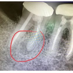 Andelin Family Dentistry - Access