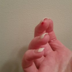Out of all the knicks and cuts I received, this one still bleeds when I touch something over 24 hours later