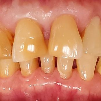 Thomas Yoon Dental - General Dentistry Near Me - Fairfax, Virginia Thomas Yoon Dental - General Dentistry Near Me - Fairfax, Virginia