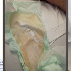 Shorrock Garden Care Center - Coral harbor not cleaning my mother this is how a UTI and sepsis starts.