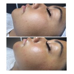 Total vanity esthetics - Skin glow