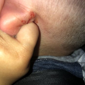 Supercuts - My son has a huge cut on his ear. He's 2. This experience just made him even more scared of getting his hair cut. - Hair Salons Near Me - ROHNERT PARK, California