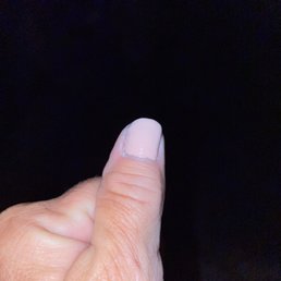 Lump at the base of my thumb