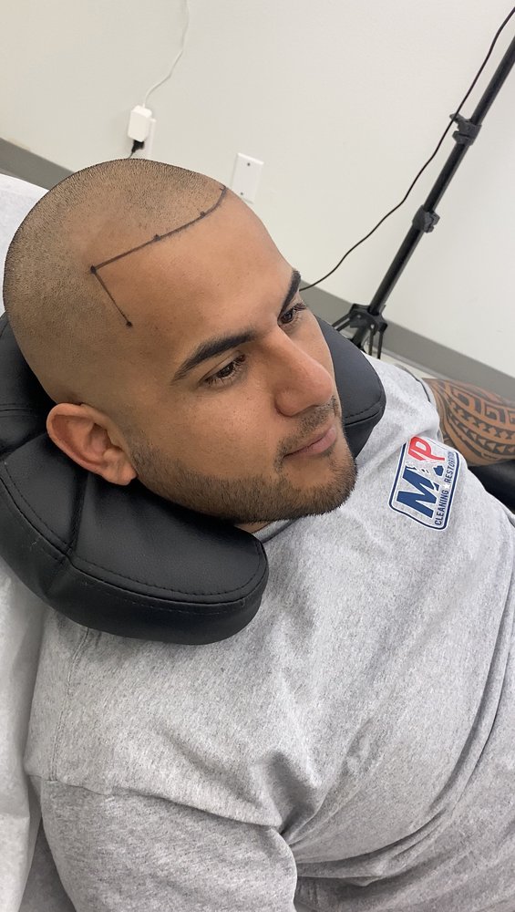 Evolution 360° Scalp Micropigmentation Logo