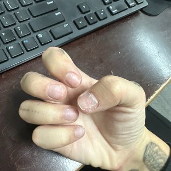 Dove Nails - What my nails loooked like when they all broke off and cracked. I had such good length before. - Nail Salons Near Me - Belmont, Massachusetts