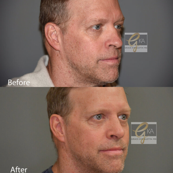 Grace Kim Austin, MD - Cosmetic Surgeons Near Me - Glendale, California Grace Kim Austin, MD - Cosmetic Surgeons Near Me - Glendale, California