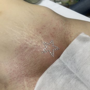 Zeng Ink and Esthetics - Brazilian Wax with Vajazzle Add-On - Skin Care Near Me - Phoenix, Arizona Zeng Ink and Esthetics - Brazilian Wax with Vajazzle Add-On - Skin Care Near Me - Phoenix, Arizona