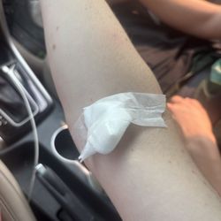 Labcorp - My poke