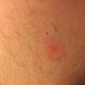 Rodeway Inn - Bed bugs - Hotels Near Me - Norfolk, Nebraska