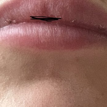 Juvia Aesthetics - Skin Care Near Me - Wayne New Jersey, New Jersey Juvia Aesthetics - Skin Care Near Me - Wayne New Jersey, New Jersey