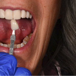 Aesthetic Oral Designs